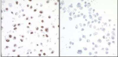 Immunohistochemistry-Paraffin: KAP1 [p Ser824] Antibody [NB100-2350]